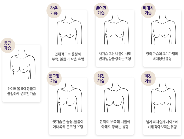 여성들의 가슴 특징 이미지 1