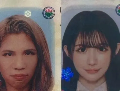 2억원치 성형결과 이미지 5