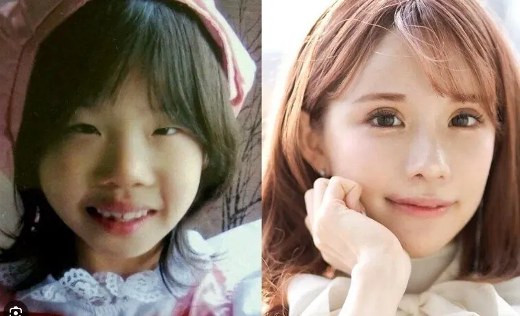 2억원치 성형결과 이미지 3
