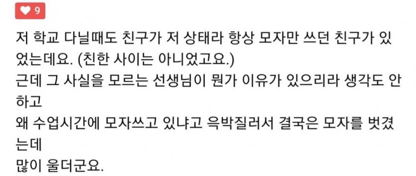 탈모가 온 중3 학생 이미지 3