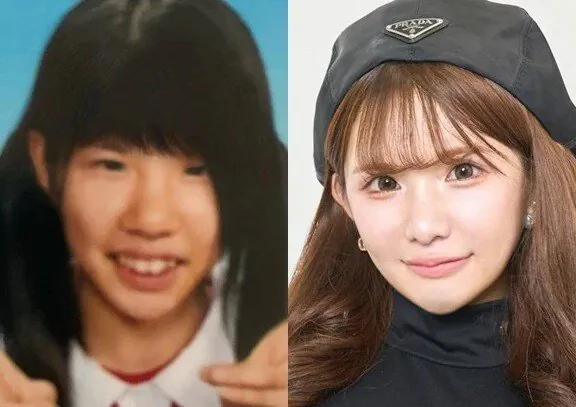 2억원치 성형결과 이미지 4
